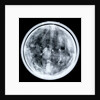 Globe x-ray by Jacques Hardy