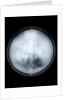 Globe x-ray by Charles Price