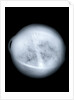 Globe x-ray by Charles Price