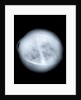 Globe x-ray by Charles Price