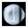 Globe x-ray by Jacques de La Feuille