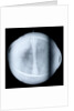 Globe x-ray by Jacques de La Feuille