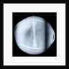Globe x-ray by Jacques de La Feuille