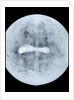 Globe x-ray by Jodocus Hondius