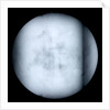 Globe x-ray by Robert Morden