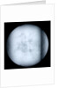 Globe x-ray by Robert Morden