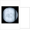 Globe x-ray by Robert Morden