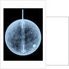 Globe x-ray by William Bardin