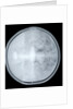 Globe x-ray by Jacob Aertsz Colom