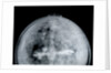 Globe x-ray by Jacob Aertsz Colom