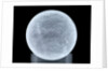 Globe x-ray by unknown