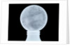 Globe x-ray by Moll