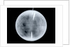 Globe x-ray by Dudley Adams