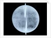 Globe x-ray by Thomas Patrick
