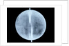 Globe x-ray by Thomas Patrick