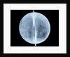Globe x-ray by Thomas Patrick