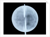 Globe x-ray by Thomas Patrick