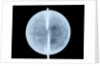 Globe x-ray by Thomas Patrick