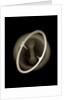 Globe x-ray by Joannes Oterschaden