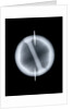 Globe x-ray by Joannes Oterschaden