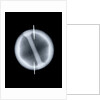 Globe x-ray by Joannes Oterschaden