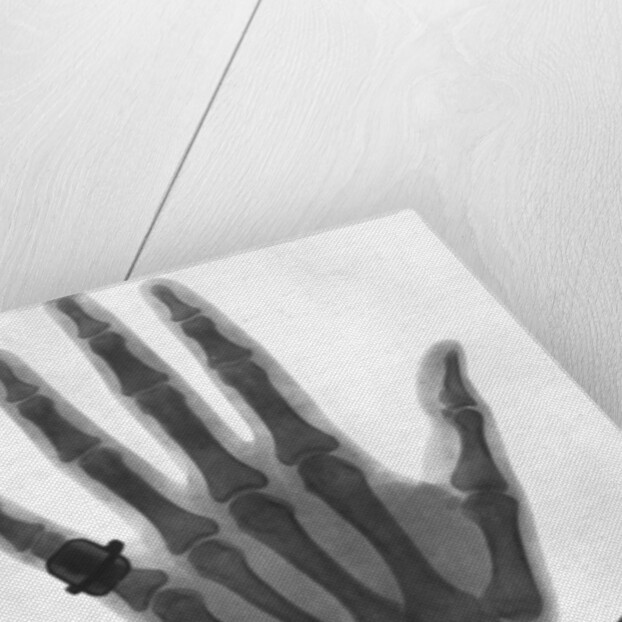 X-ray photograph of a hand by Anonymous