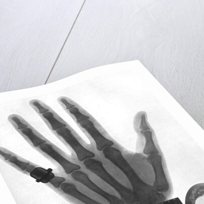 X-ray photograph of a hand by Anonymous