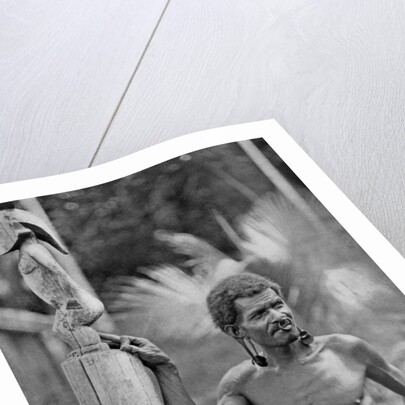 Malformation of the ears, Solomon Islands by JW Beattie
