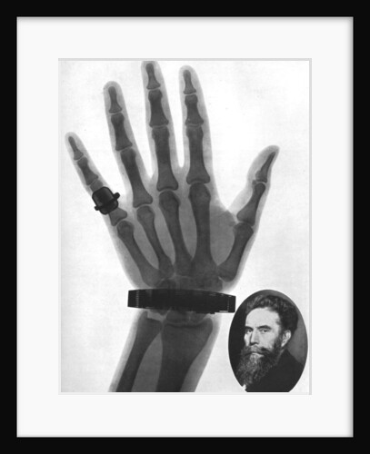 X-ray photograph of a hand by Anonymous
