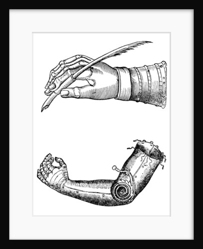 Artificial limbs by Anonymous