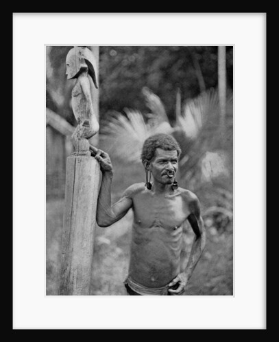Malformation of the ears, Solomon Islands by JW Beattie