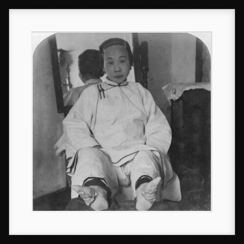 A high caste lady's dainty 'lily feet', showing method of deformity by Underwood & Underwood