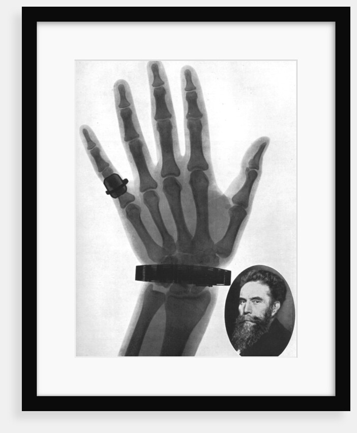 X-ray photograph of a hand by Anonymous