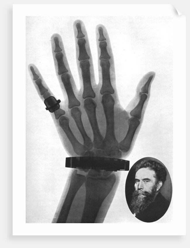 X-ray photograph of a hand by Anonymous