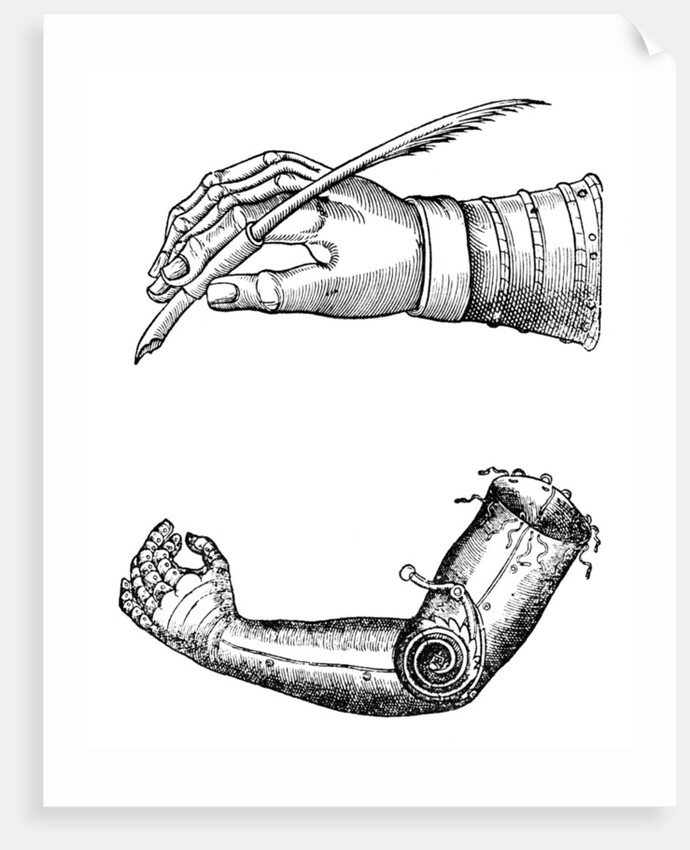 Artificial limbs by Anonymous