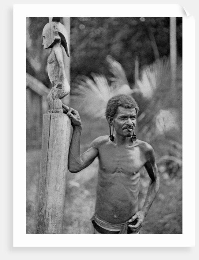 Malformation of the ears, Solomon Islands by JW Beattie