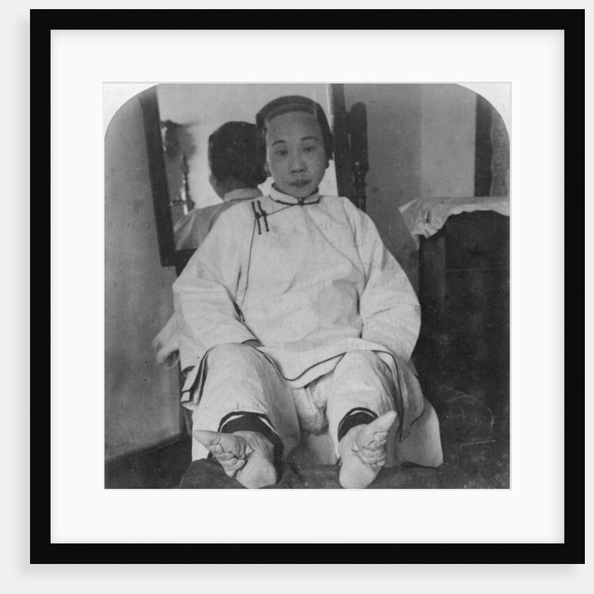 A high caste lady's dainty 'lily feet', showing method of deformity by Underwood & Underwood