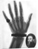 X-ray photograph of a hand by Anonymous