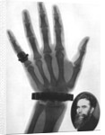 X-ray photograph of a hand by Anonymous