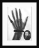 X-ray photograph of a hand by Anonymous