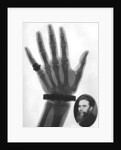 X-ray photograph of a hand by Anonymous