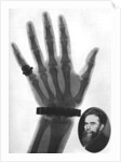 X-ray photograph of a hand by Anonymous