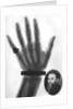 X-ray photograph of a hand by Anonymous