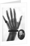 X-ray photograph of a hand by Anonymous