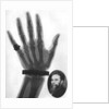 X-ray photograph of a hand by Anonymous