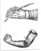 Artificial limbs by Anonymous
