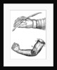 Artificial limbs by Anonymous