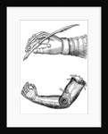 Artificial limbs by Anonymous