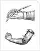 Artificial limbs by Anonymous