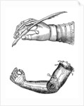 Artificial limbs by Anonymous